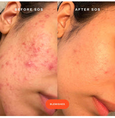 Tower 28 - SOS Rescue Spray 30ml