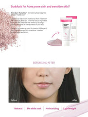 KSECRET - Calamine Secret Sunblock (physical sunblock) 50ml