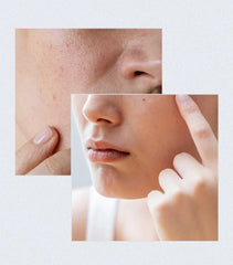 Anua - Birch 70 Moisture Boosting Serum 30ml