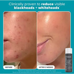 Paula's Choice Exfoliation Icons Kit