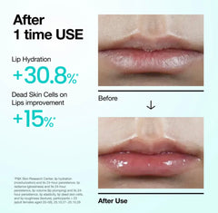 Anua - PDRN Lip Serum