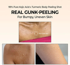 Dr.Melaxin - Peel Shot Exfoliating Kojic Acid Turmeric Spray 200ml