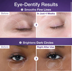 numbuzin - No.9 3 Days Eye Care Kit