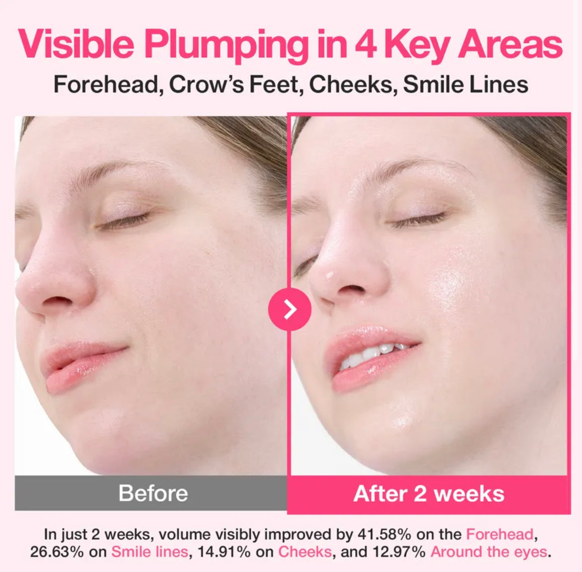 numbuzin - No.2 Rose PDRN Collagen Plumping Serum 30ml