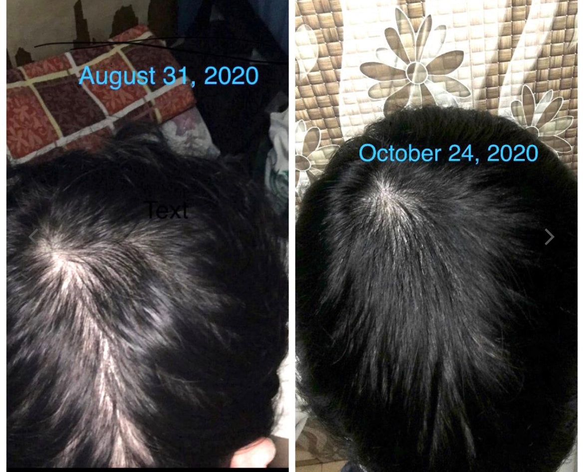 KAMINOMOTO - Hair Growth Trigger 180ml