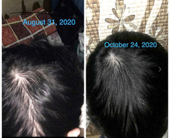 KAMINOMOTO - Hair Growth Trigger 180ml