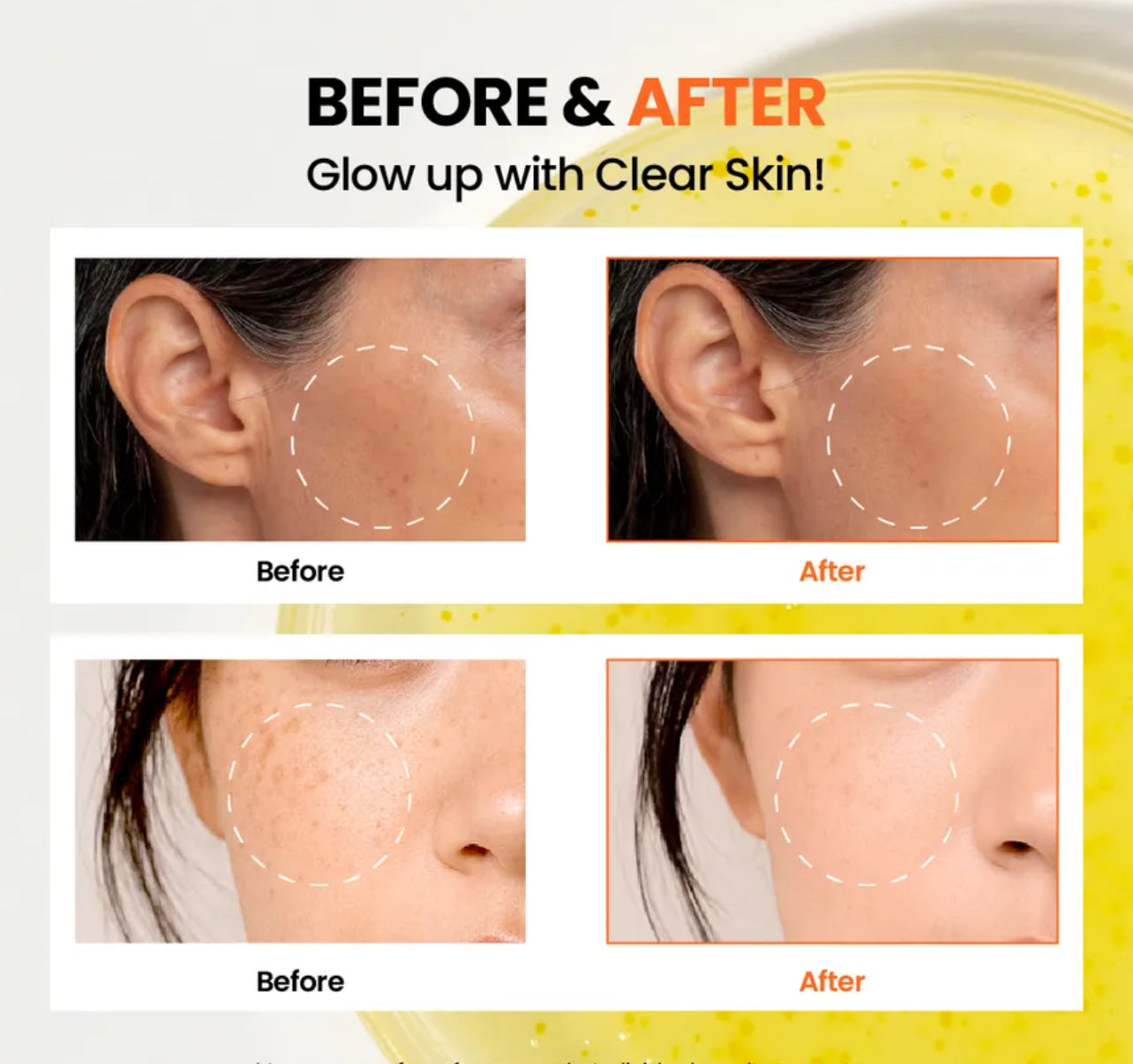 KSECRET - SEOUL 1988 Glow Serum : Niacinamide 15% + Yuja 30ml